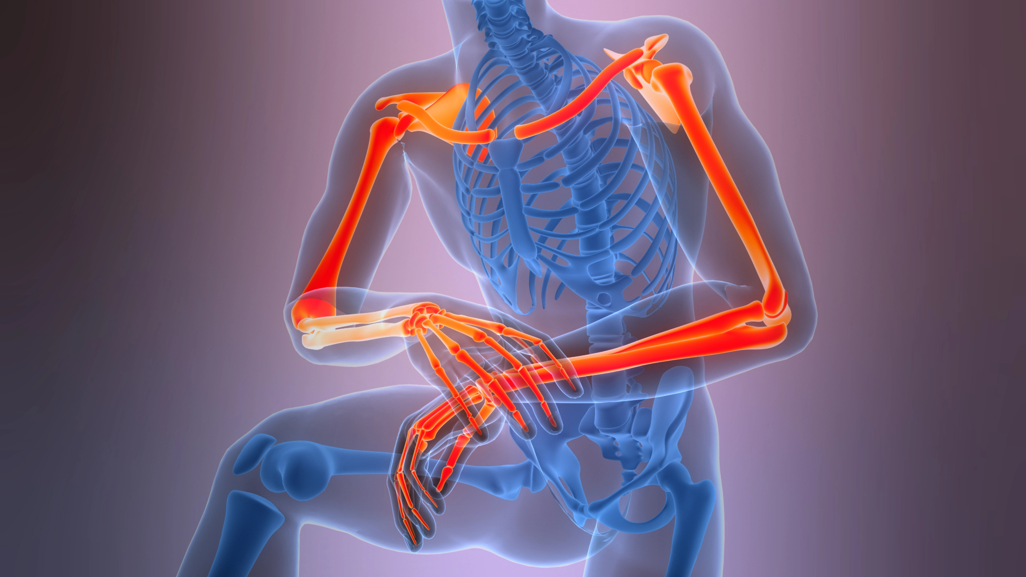 Rizartroza - ko bolečina v palcu ni več le utrujenost